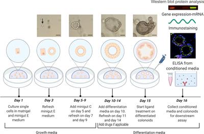 Comprehensive protocols for culturing and molecular biological analysis of IBD patient-derived colon epithelial organoids